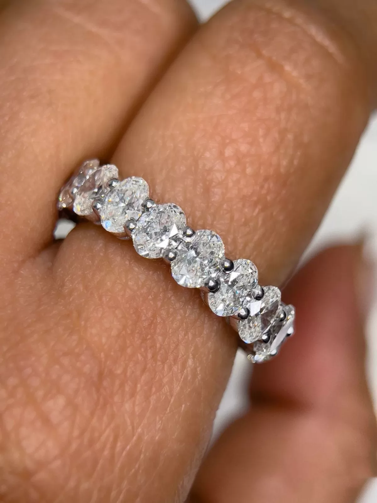 wedding ring itchy